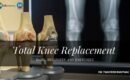 total knee replacement risks, recovery, and exercises