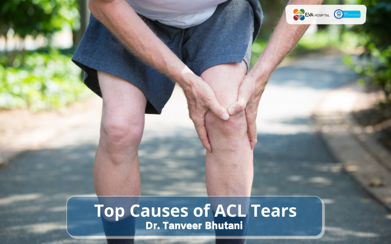 Top Causes of ACL Tears