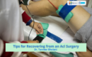 Tips for Recovering from an Acl Surgery