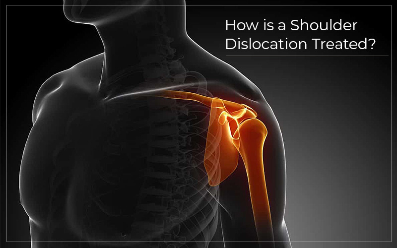 How-is-shoulder-dislocation-treated-