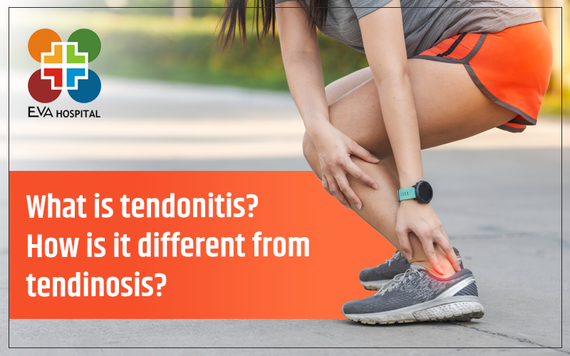 What is Tendonitis? How is it Different from Tendinosis?