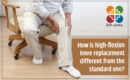 How is high-flexion knee replacement different from the standard one?